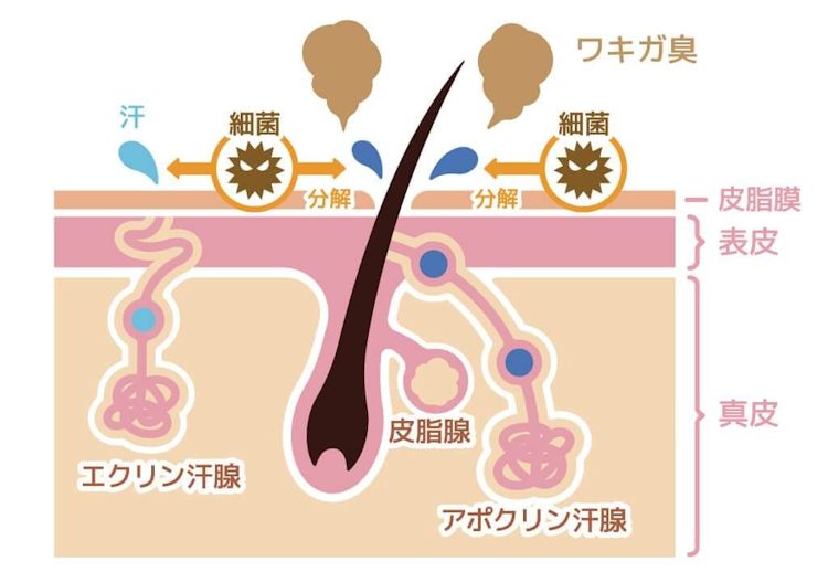 ワキガ